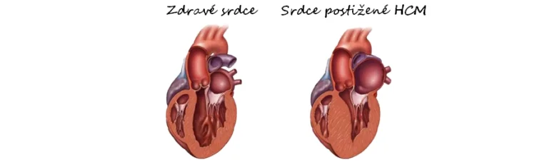 HCM u koček: příznaky, diagnostika a účinná léčba